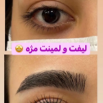 لیفت مژه