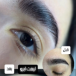 لیفت ابرو