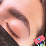 لیفت ابرو