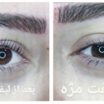 لیفت مژه