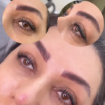 لیفت مژه