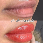 شیدینگ لب