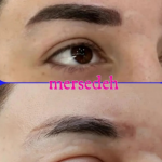 میکروبلیدینگ ابرو