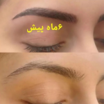 میکروبلیدینگ ابرو