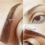 میکروبلیدینگ ابرو