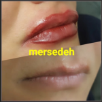 شیدینگ لب