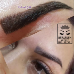 میکروبلیدینگ ابرو