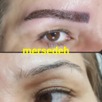 میکروبلیدینگ ابرو