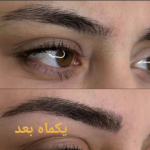 میکروبلیدینگ ابرو
