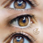 بن مژه