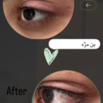 بن مژه