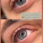 بن مژه
