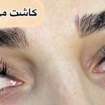 اکستنشن مژه