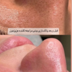 فشیال