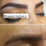 میکروبلیدینگ