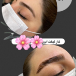 لیفت ابرو