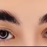 لیفت ابرو
