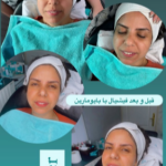 فشیال