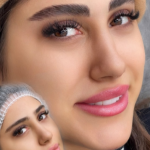 میکروبلیدینگ ابرو