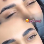 لیفت ابرو