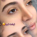 لیفت ابرو
