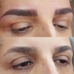 میکروبلیدینگ ابرو