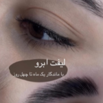 لیفت ابرو