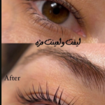 لیفت مژه
