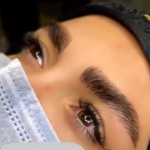 فیبروز ابرو