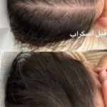 اسکراب