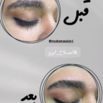اصلاح ابرو