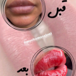 شیدینگ لب